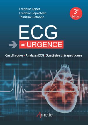 boca Tratamiento Proporcional Librairie Médicale - ECG en urgence (3e édition)